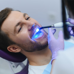 UV light being applied to man’s filling