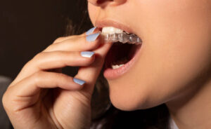 Close up of woman wearing Invisalign